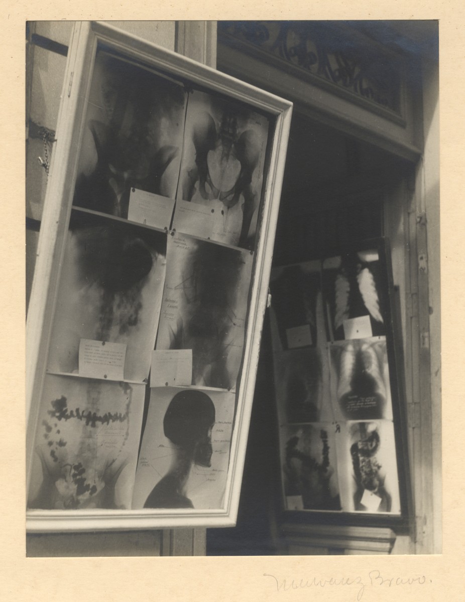 Ventana de radiographie (X-ray Window)